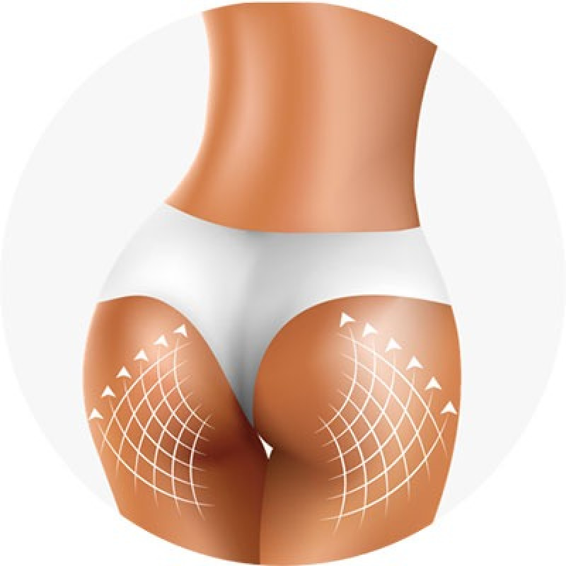 Антицеллюлитная сыворотка Medica Group Beauty Booty Serum для ягодиц 150 мл Антицеллюлитная сыворотка Medica Group Beauty Booty Serum для ягодиц 150 мл