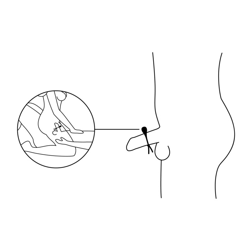 Ерекційне віброкільце-ласо Nexus FORGE Vibrating, 6 режимів Ерекційне віброкільце-ласо Nexus FORGE Vibrating, 6 режимів
